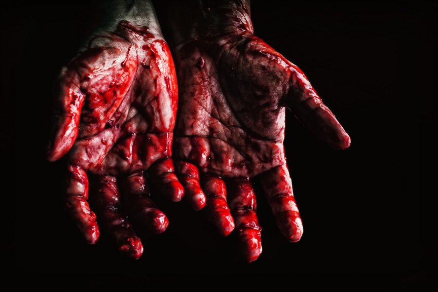 bloody hands